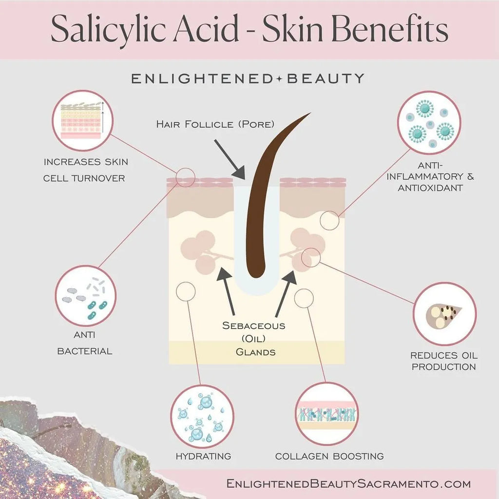 Triac Anti Acne Face Wash