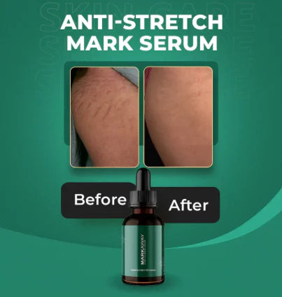 Markaway Stretch Mark Serum