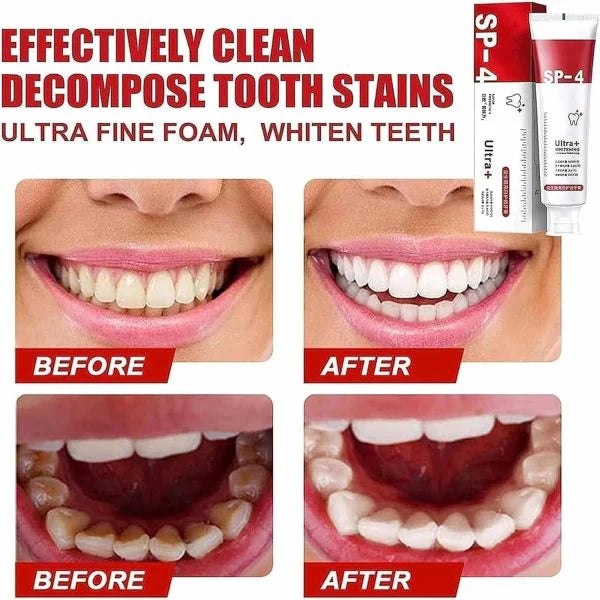 SP4 Ultra Whitening Toothpaste