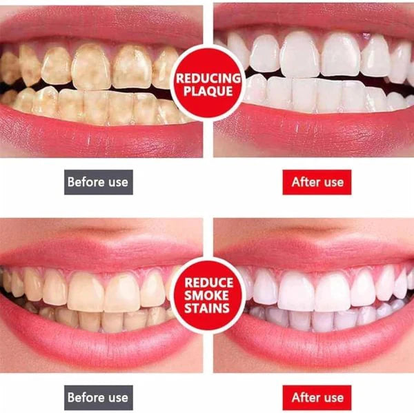 SP4 Ultra Whitening Toothpaste